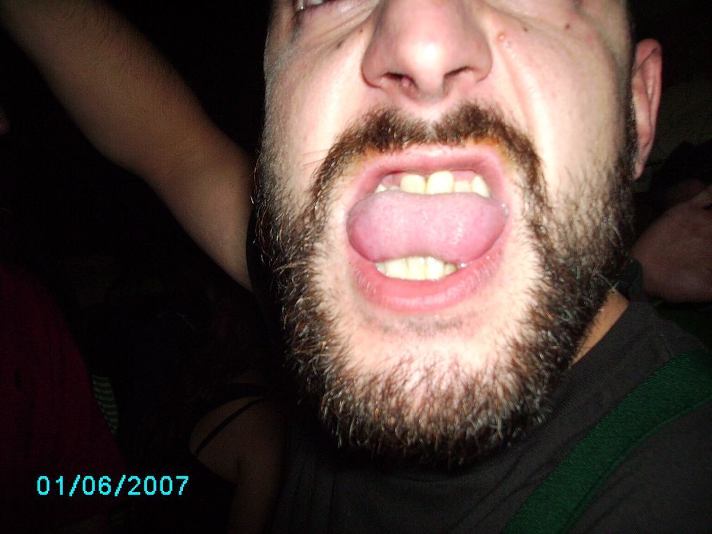 Use 'view image' in your browser to see full size image